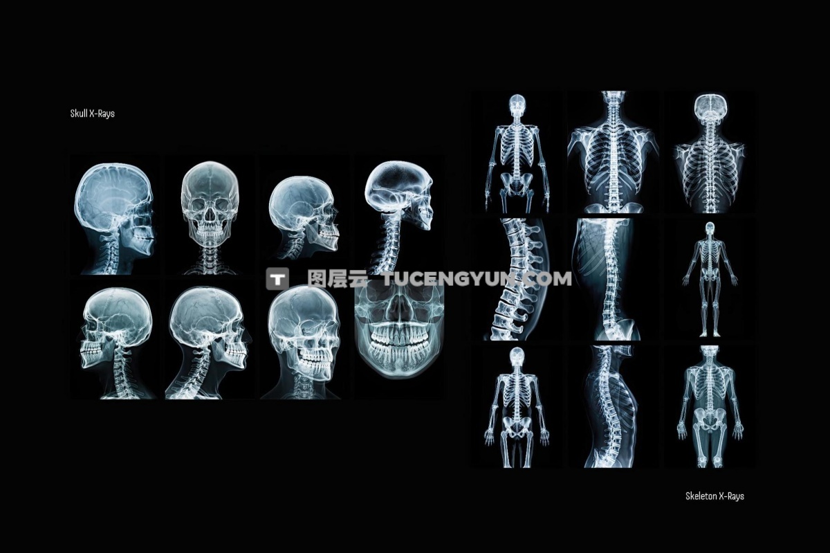 72款暗黑X光骨骼数字艺术医学图像造影背景肌理特效样机+JPG套装 Hyper XRays Collection（12192）图层云